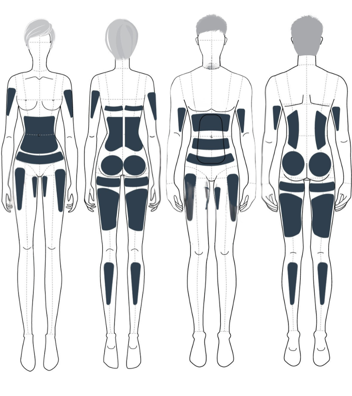 Noble Shape body treatment areas